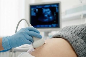 Close up of a doctors gloved hand using an ultrasound transducer on a pregnant patients abdomen. A sonogram screen is visible in the background during the medical examination.